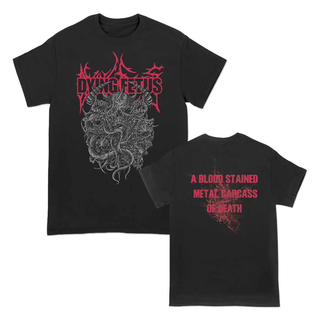 Dying Fetus's 